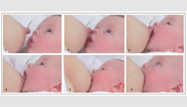 5 Bước để có một khớp ngậm bú đúng cho trẻ sơ sinh   