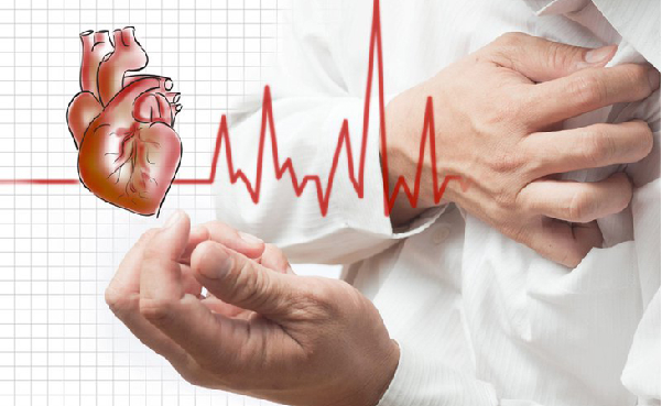 Các vấn đề cần biết về bệnh động mạch vành (CAD)