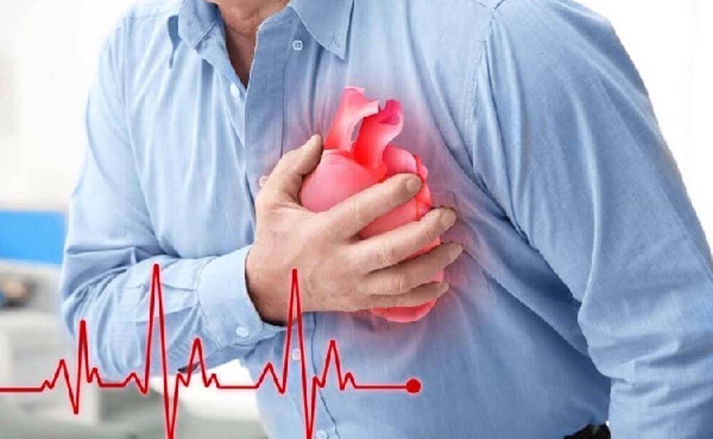 Suy tim là bệnh như thế nào? Phòng ngừa và điều trị ra sao?